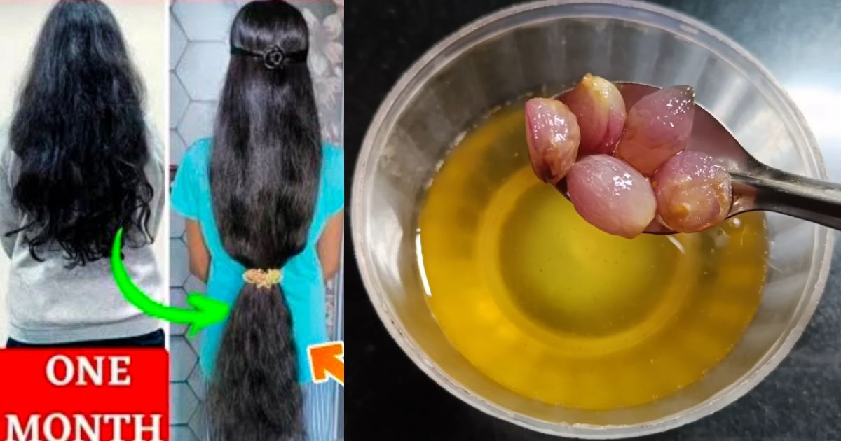 Small-Onion-Oil-For-Fast-Hair-Growth-2